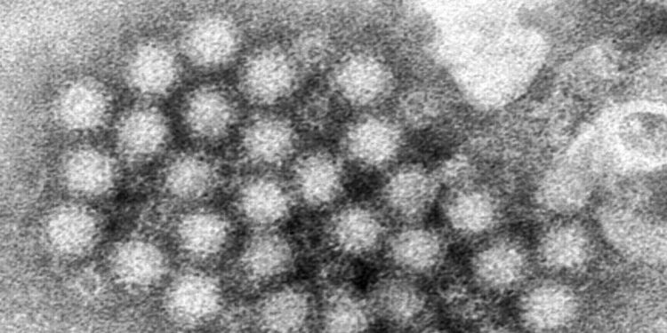 Nasty norovirus is back in full force with US cases of the stomach virus surging