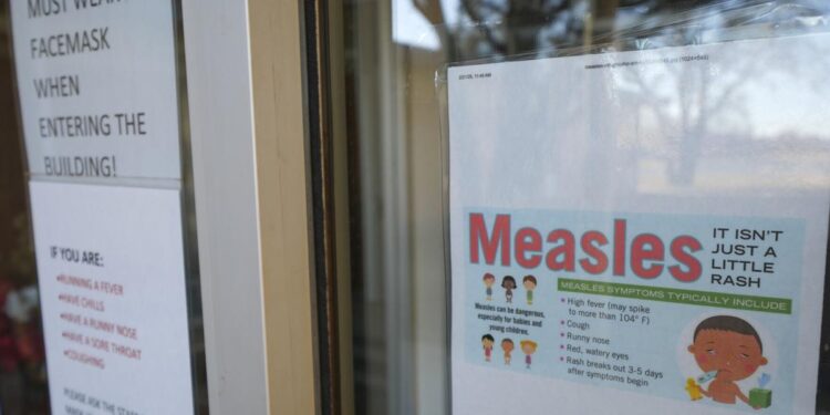 A Texas child who was not vaccinated has died of measles, a first for the US in a decade