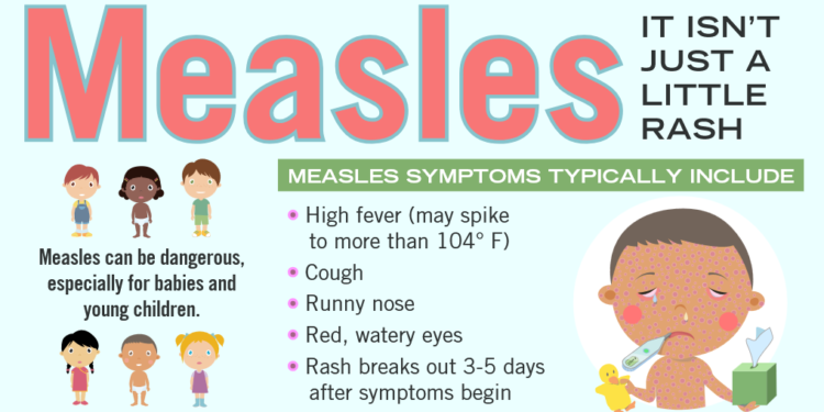 Two cases of measles confirmed in Oklahoma