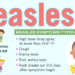 Two cases of measles confirmed in Oklahoma